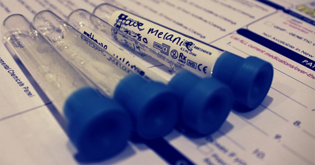 How to Read Blood Test Results: 5 Common Test Results Decoded